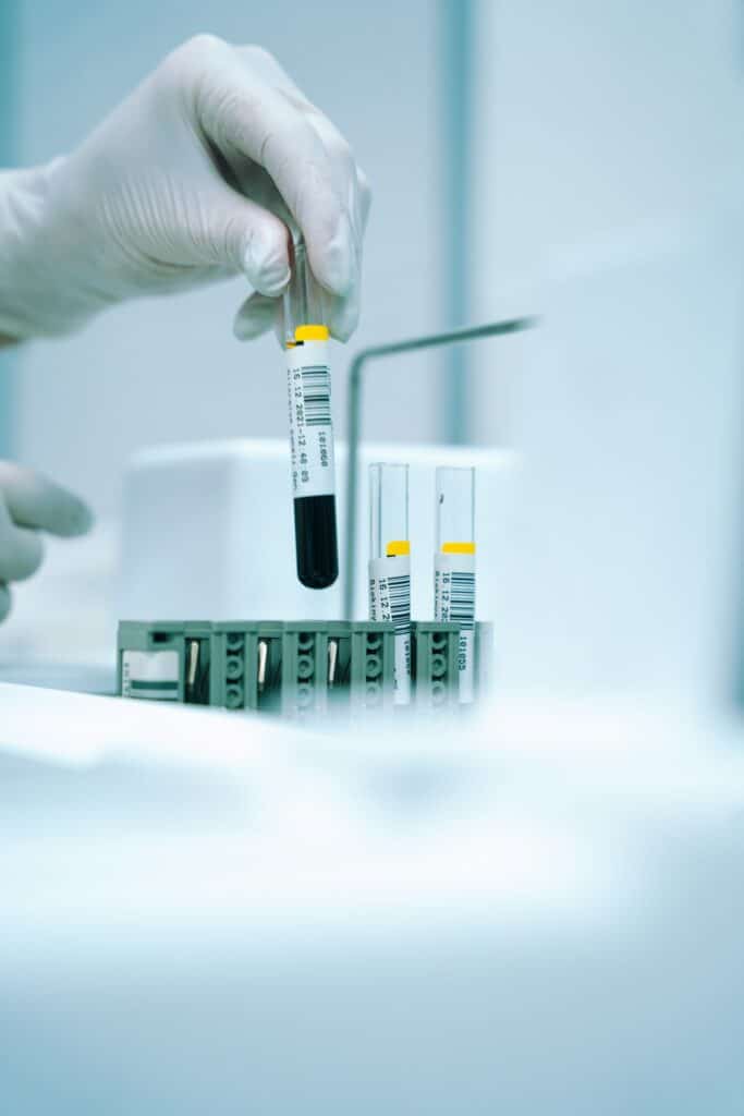 Blood sample tube for bone health blood work at Integria Precision Medicine in Calgary