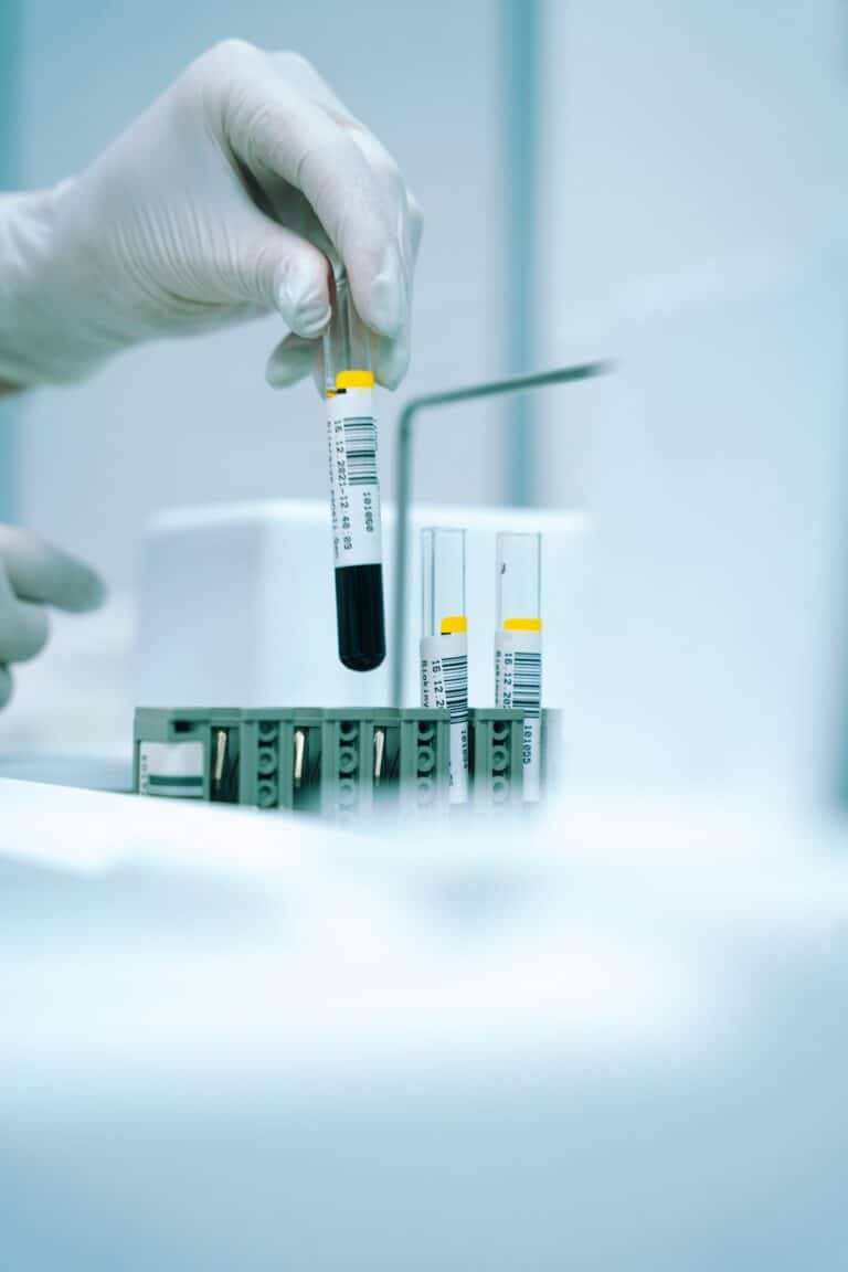 Blood sample tube for bone health blood work at Integria Precision Medicine in Calgary