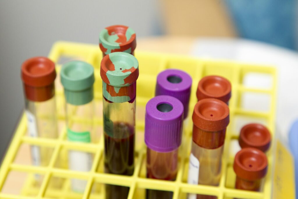 Laboratory blood sample tubes for the comprehensive blood work panel at Integria Precision Medicine