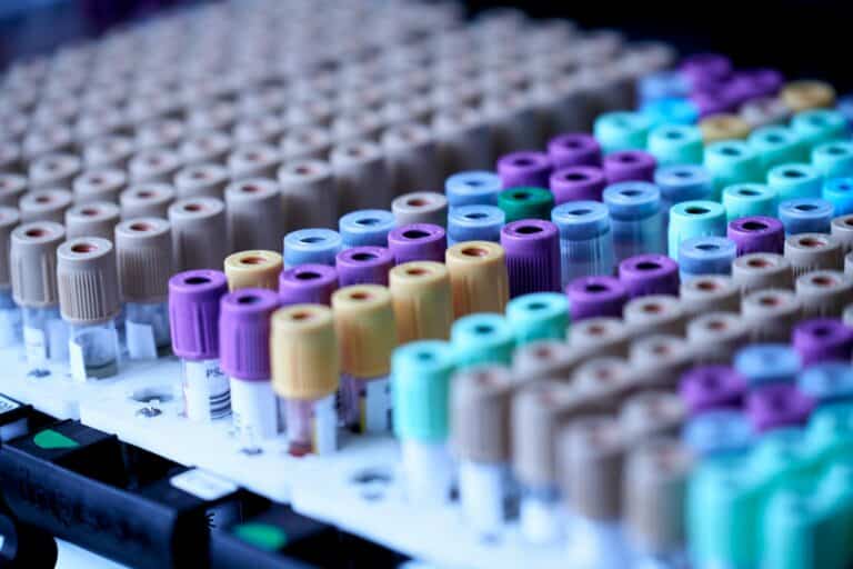 Blood sample tubes for extended metabolic blood work at Integria Precision Medicine
