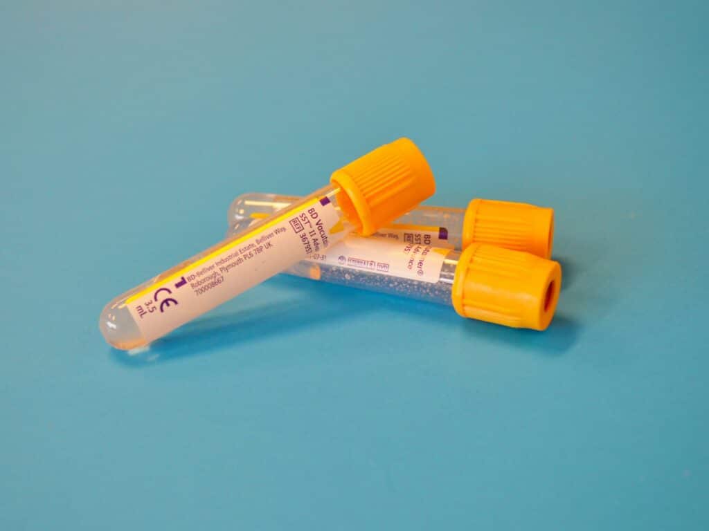 Blood collection tube for the longevity hormone assessment at Integria Precision Medicine